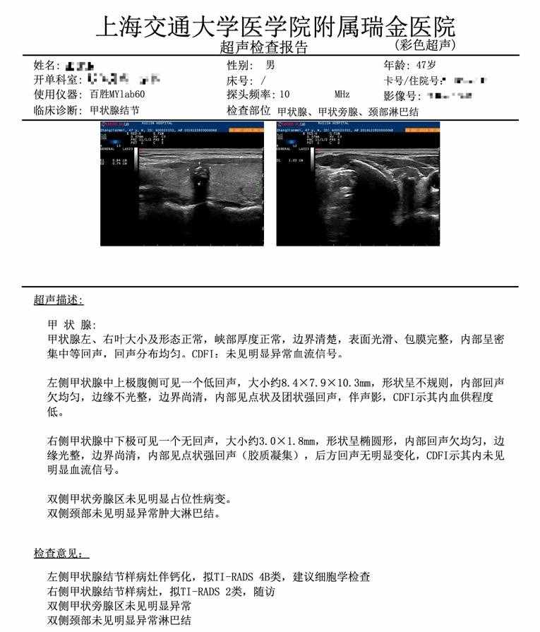 七个问答，全面了解甲状腺结节
