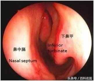 鼻子总是不通气？别大意！可能是这6种疾病的征兆！