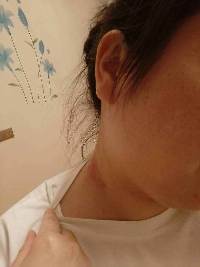 关于无花果汁的功效