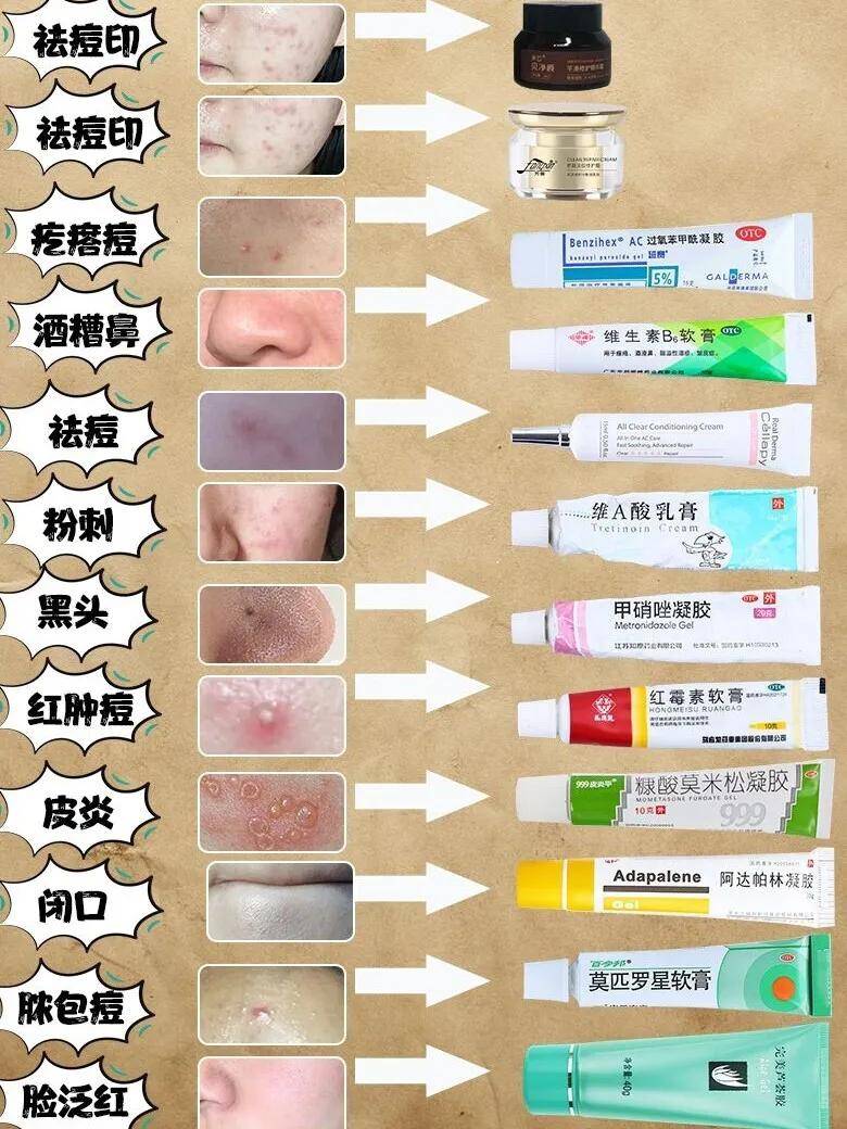 祛痘印护肤干货,痘肌自备皮肤药膏合集