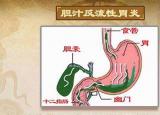 今日更新反流性胃炎（胆汁反流性胃炎）