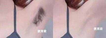 再不脱毛就晚了，4 种靠谱脱毛方式，肌肤光溜一夏