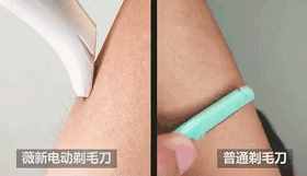 再不脱毛就晚了，4 种靠谱脱毛方式，肌肤光溜一夏