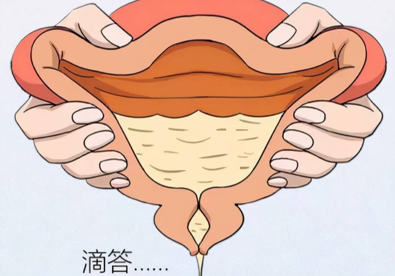 女性尿道口的结构是怎样的?