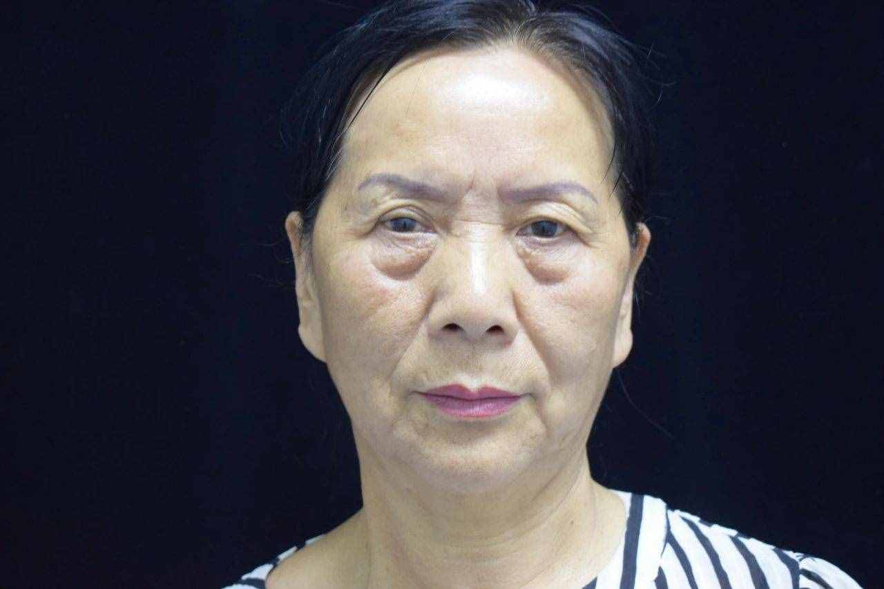最显老的不是皱纹，而是眼袋！祛除眼袋的3个妙招，简单效果好