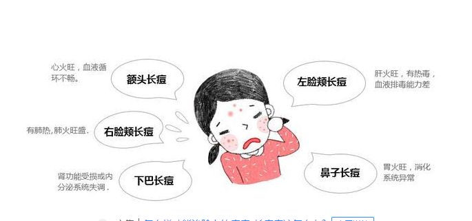 教你如何不长痘？日常护肤多注意这些