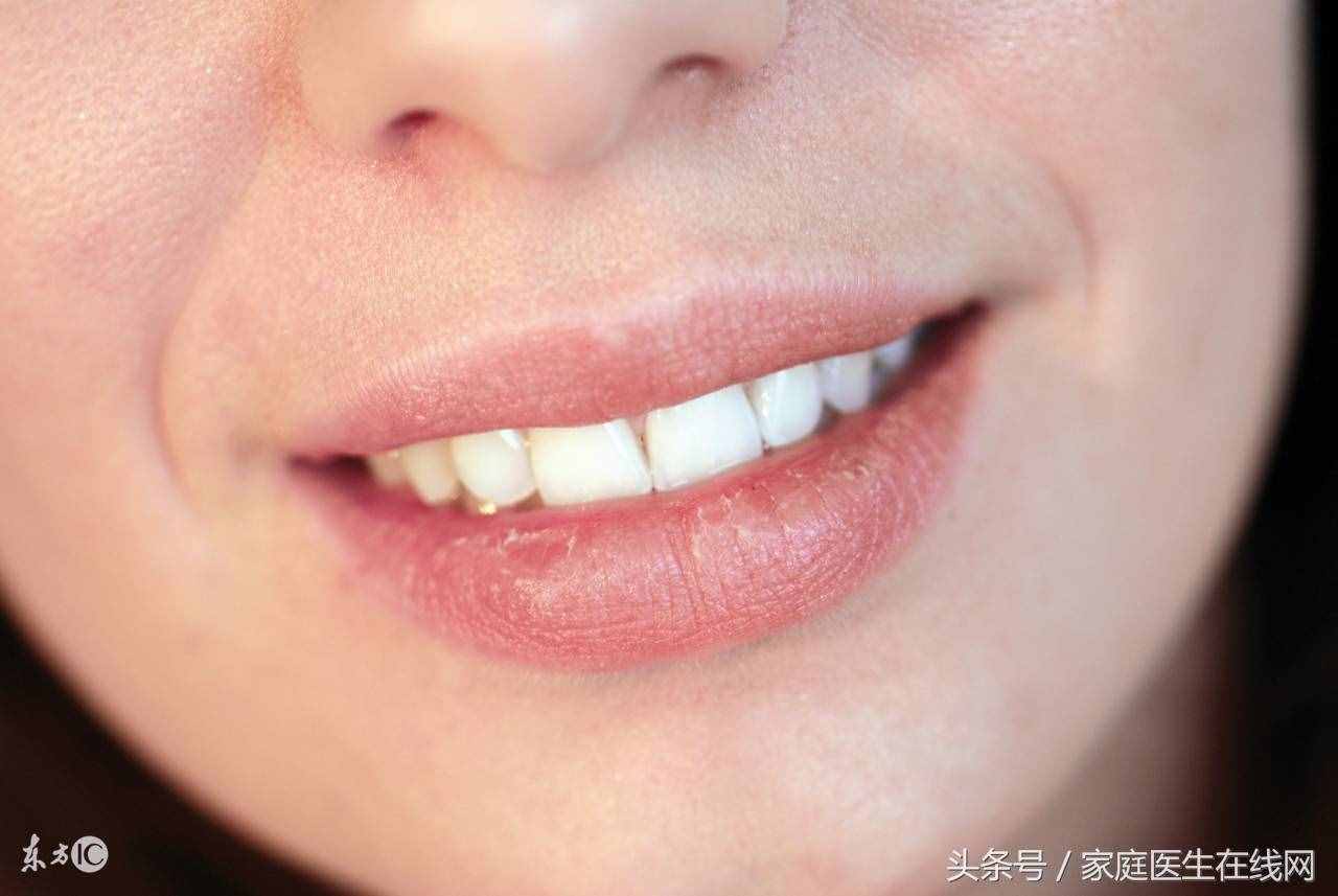 老中医公布秘方：多吃点这9种食物，什么火都能降下去