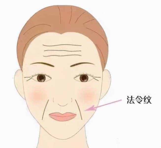 法令纹是如何形成的？怎么改善弱化法令纹？