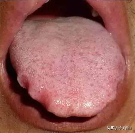 十全大补丸到底有多补！你知道吗？