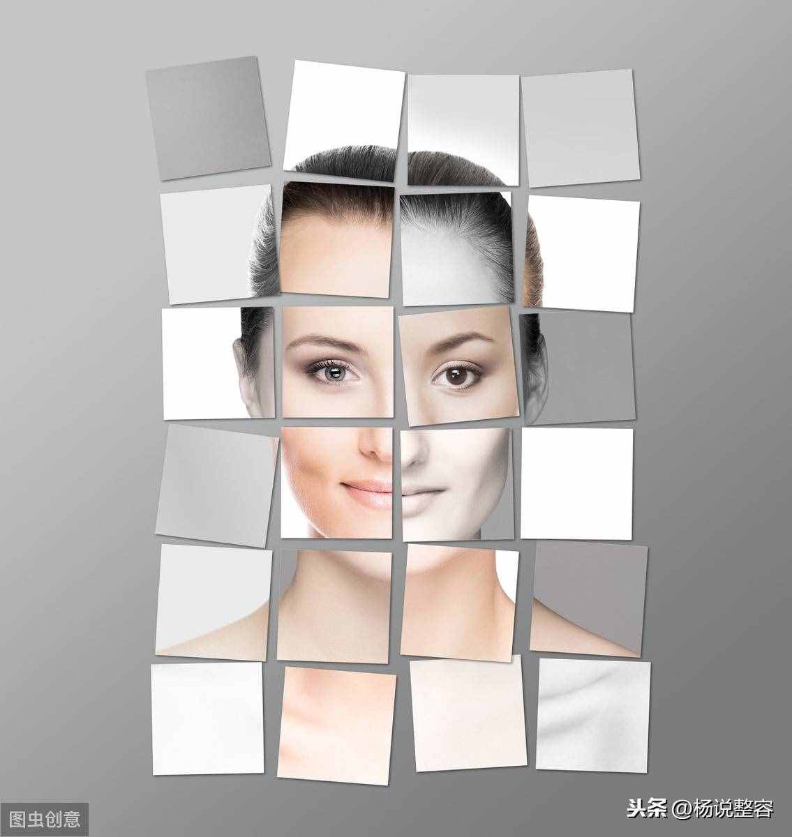 面部整形之面部除皱术，优缺点、术后肿胀等问题解答
