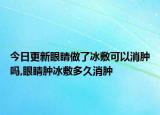 今日更新眼睛做了冰敷可以消肿吗,眼睛肿冰敷多久消肿