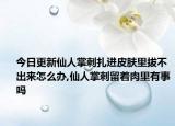 今日更新仙人掌刺扎进皮肤里拔不出来怎么办,仙人掌刺留着肉里有事吗