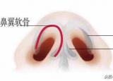 今日更新鼻头太大怎么变小（有什么好办法能让大鼻头变小）