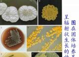 今日更新放线菌阅读答案（环境微生物之放线菌）