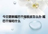 今日更新嘴巴干燥脱皮怎么办 嘴巴干燥吃什么