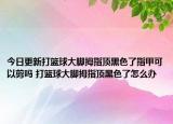 今日更新打篮球大脚拇指顶黑色了指甲可以剪吗 打篮球大脚拇指顶黑色了怎么办