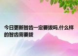 今日更新智齿一定要拔吗,什么样的智齿需要拔