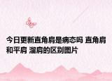 今日更新直角肩是病态吗 直角肩和平肩 溜肩的区别图片