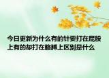 今日更新为什么有的针要打在屁股上有的却打在胳膊上区别是什么