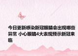 今日更新感染新冠眼睛会出现哪些异常 小心眼睛4大表现预示新冠来临