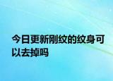 今日更新刚纹的纹身可以去掉吗