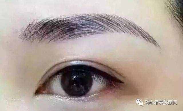 绣眉的方法包括几种？