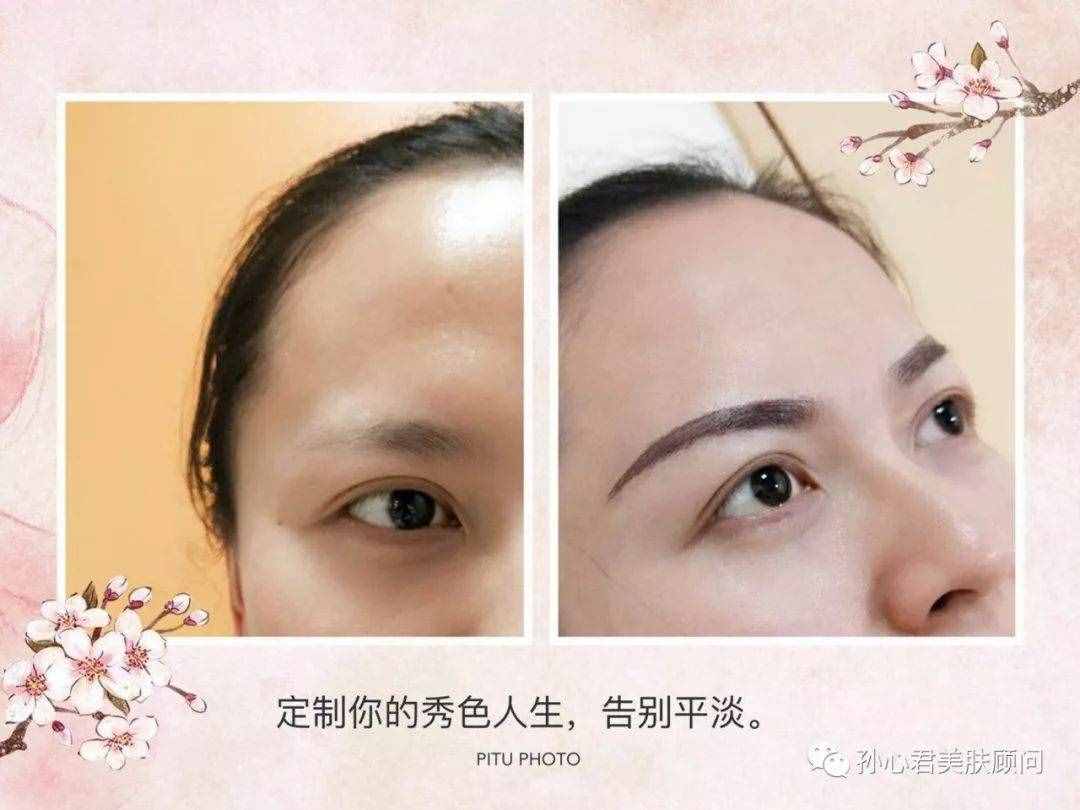 绣眉的方法包括几种？