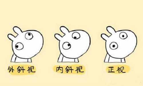 孙沣博士眼科普丨斗鸡眼如何矫正