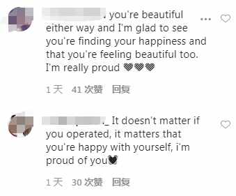 韩国男星晒整容前后对比，差距太大很惊人，被指最新照鼻尖像有坑