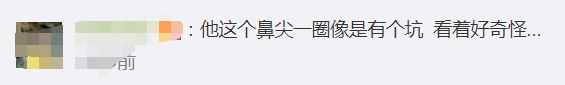 韩国男星晒整容前后对比，差距太大很惊人，被指最新照鼻尖像有坑