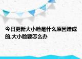 今日更新大小脸是什么原因造成的,大小脸要怎么办