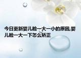 今日更新婴儿脸一大一小的原因,婴儿脸一大一下怎么矫正