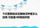 今日更新起床后眼睛浮肿是怎么回事,可能是3种原因所致