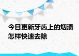 今日更新牙齿上的烟渍怎样快速去除