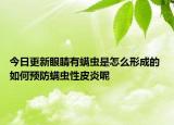 今日更新眼睛有螨虫是怎么形成的 如何预防螨虫性皮炎呢