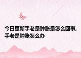 今日更新手老是肿胀是怎么回事,手老是肿胀怎么办