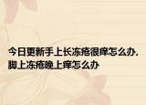 今日更新手上长冻疮很痒怎么办,脚上冻疮晚上痒怎么办