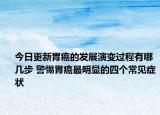 今日更新胃癌的发展演变过程有哪几步 警惕胃癌最明显的四个常见症状