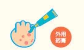 叫癣不是“癣”，细数牛皮癣的那些事