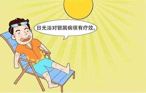 叫癣不是“癣”，细数牛皮癣的那些事