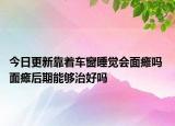 今日更新靠着车窗睡觉会面瘫吗 面瘫后期能够治好吗