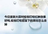 今日更新大蒜对蚊虫叮咬红肿效果好吗,蚊虫叮咬后留下的黑印怎么去掉