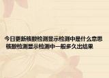 今日更新核酸检测显示检测中是什么意思 核酸检测显示检测中一般多久出结果