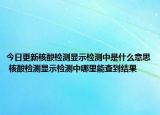 今日更新核酸检测显示检测中是什么意思 核酸检测显示检测中哪里能查到结果