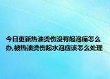 今日更新热油烫伤没有起泡痛怎么办,被热油烫伤起水泡应该怎么处理