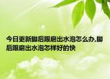 今日更新脚后跟磨出水泡怎么办,脚后跟磨出水泡怎样好的快