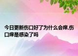 今日更新伤口好了为什么会痒,伤口痒是感染了吗