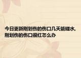 今日更新刚划伤的伤口几天能碰水,刚划伤的伤口很红怎么办
