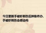 今日更新手被虾刺伤后肿胀咋办,手被虾刺伤会感染吗