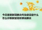 今日更新新冠肺炎传染途径是什么 怎么诊断新型冠状感染肺炎